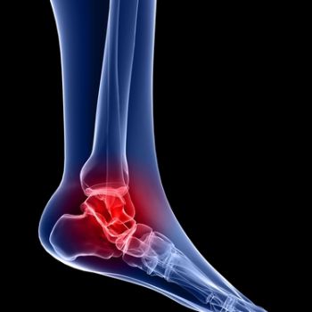 Foot and Ankle Physical Therapy