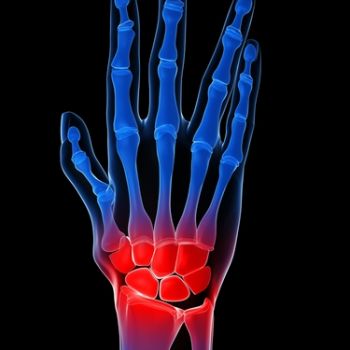 Wrist and Hand Physical Therapy